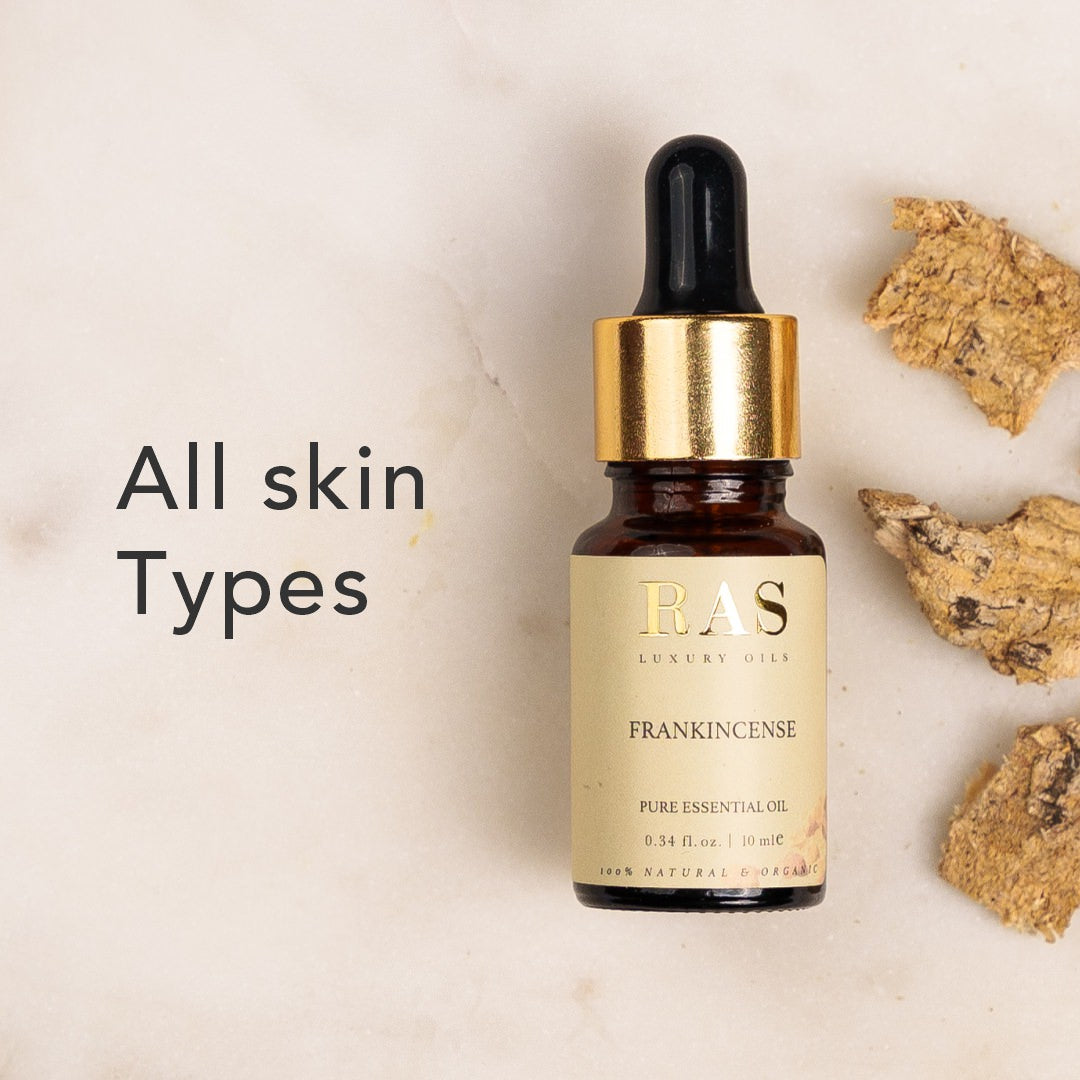 Frankincense Pure Essential Oil – Frankincense Pure Essential Oil, image 4