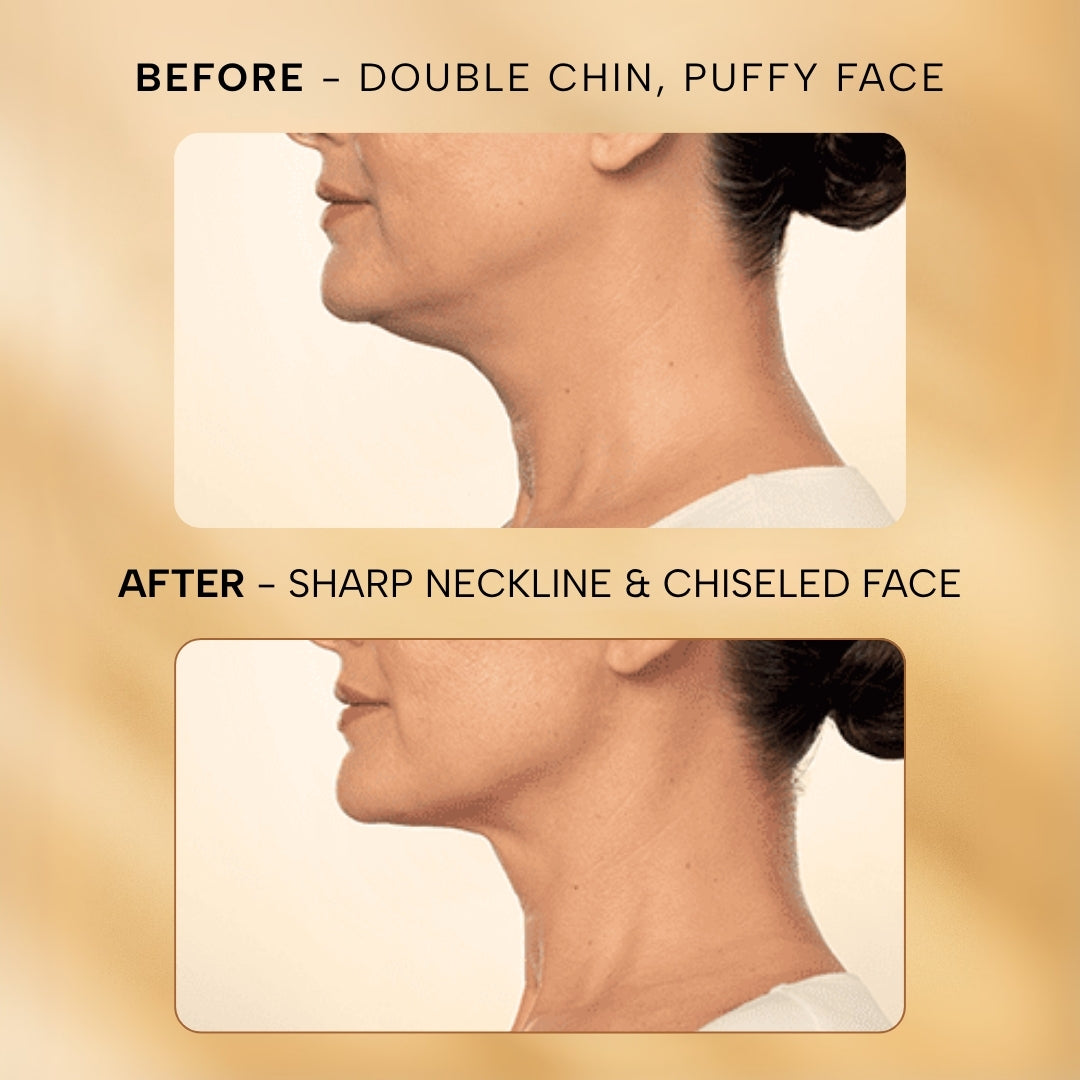 Skin Lift Electric Facial & Neck Massager