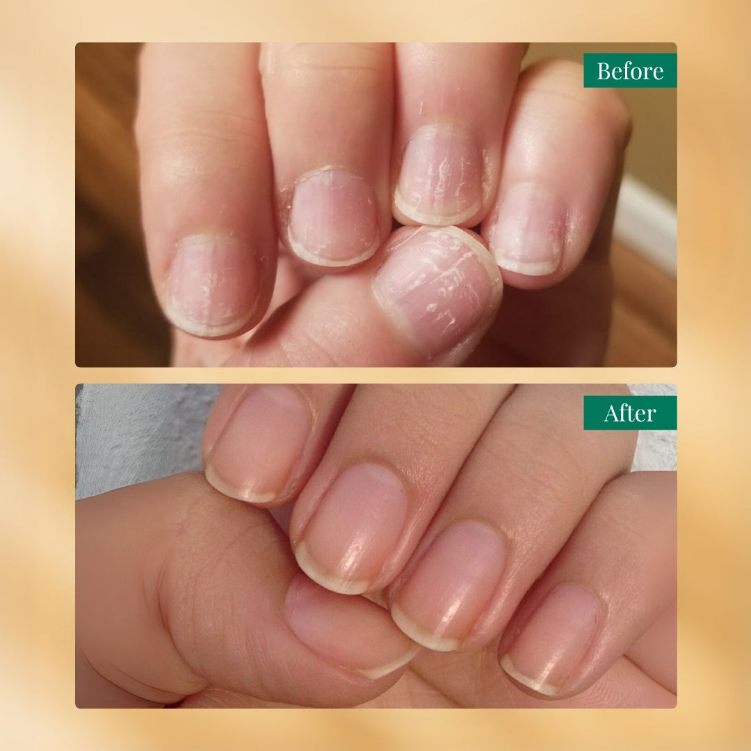 Nailchemy™ Strengthening Nail Serum