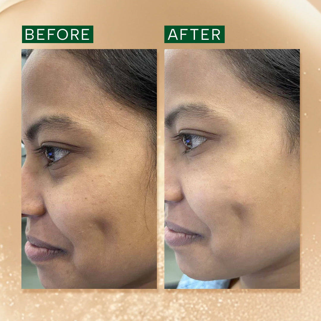 Brightening & Anti Pigmentation Advanced Booster Serum – 30ML, image 9
