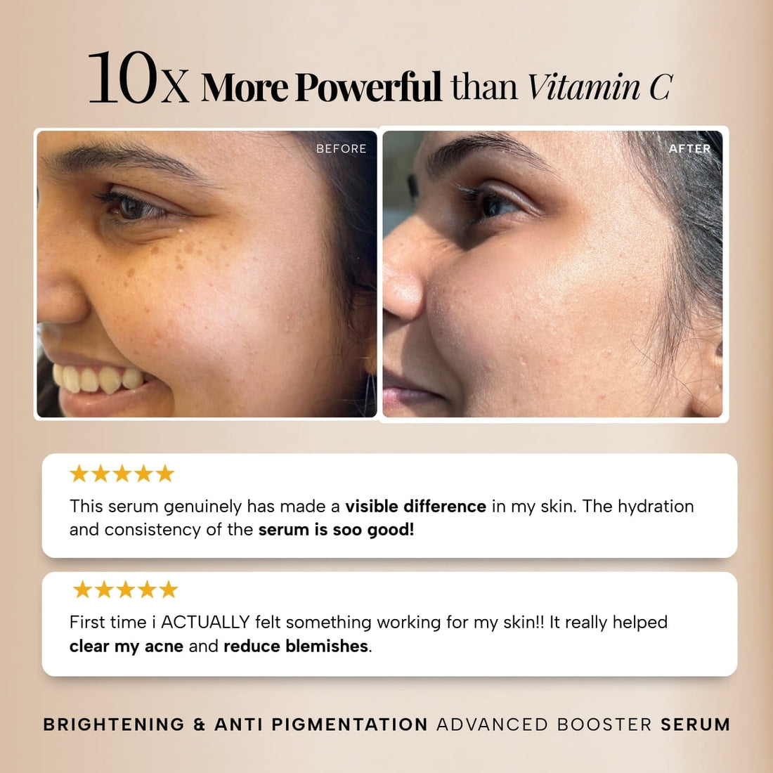 Brightening & Anti Pigmentation Advanced Booster Serum – 30ML, image 5