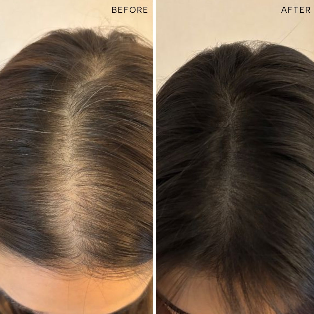 Root-ine™ Hair Elixir with 30 Regenerative Botanicals – 50ML, image 7