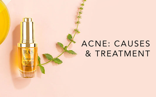 Acne: Causes and Treatment