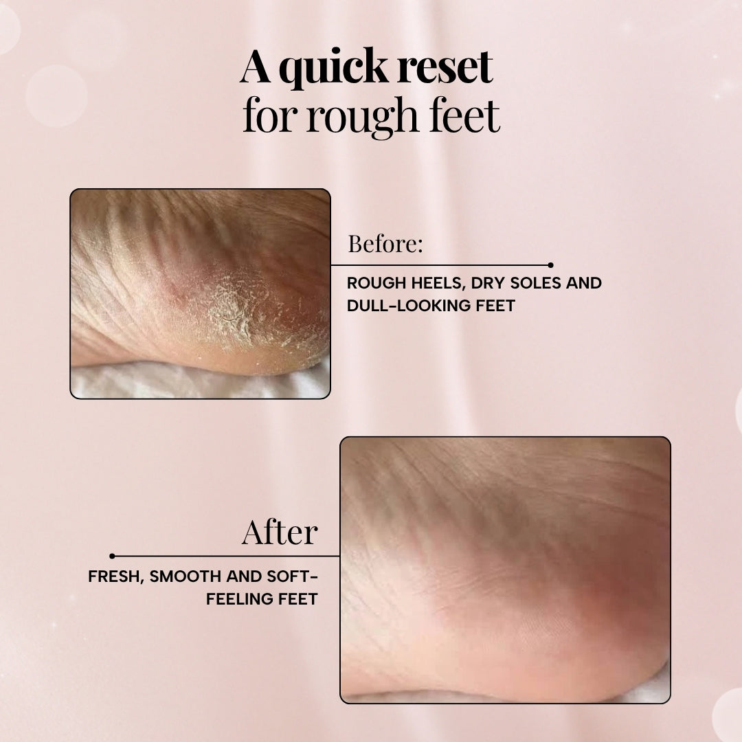 Velvet Feet Exfoliating Foot Facial Mist