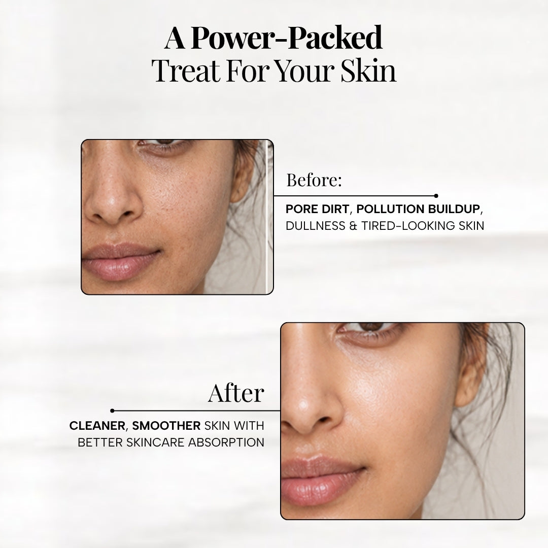 Free Ionic Skin Purifying Electrical Face Tool + Radiance Face Wash