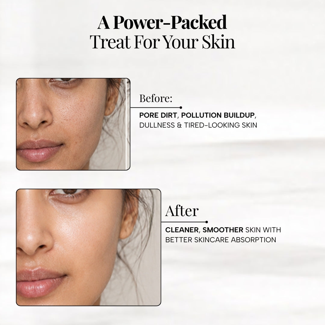 Skin Purifying Ionic Electrical Facial Device