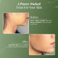 3D Ultrasonic Electric Skin Sculptor
