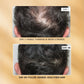 Root-ine™ Hair Growth Serum with Redensyl & Rosemary
