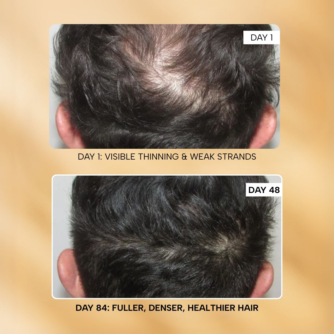Root-ine™ Hair Growth Serum with Redensyl & Rosemary