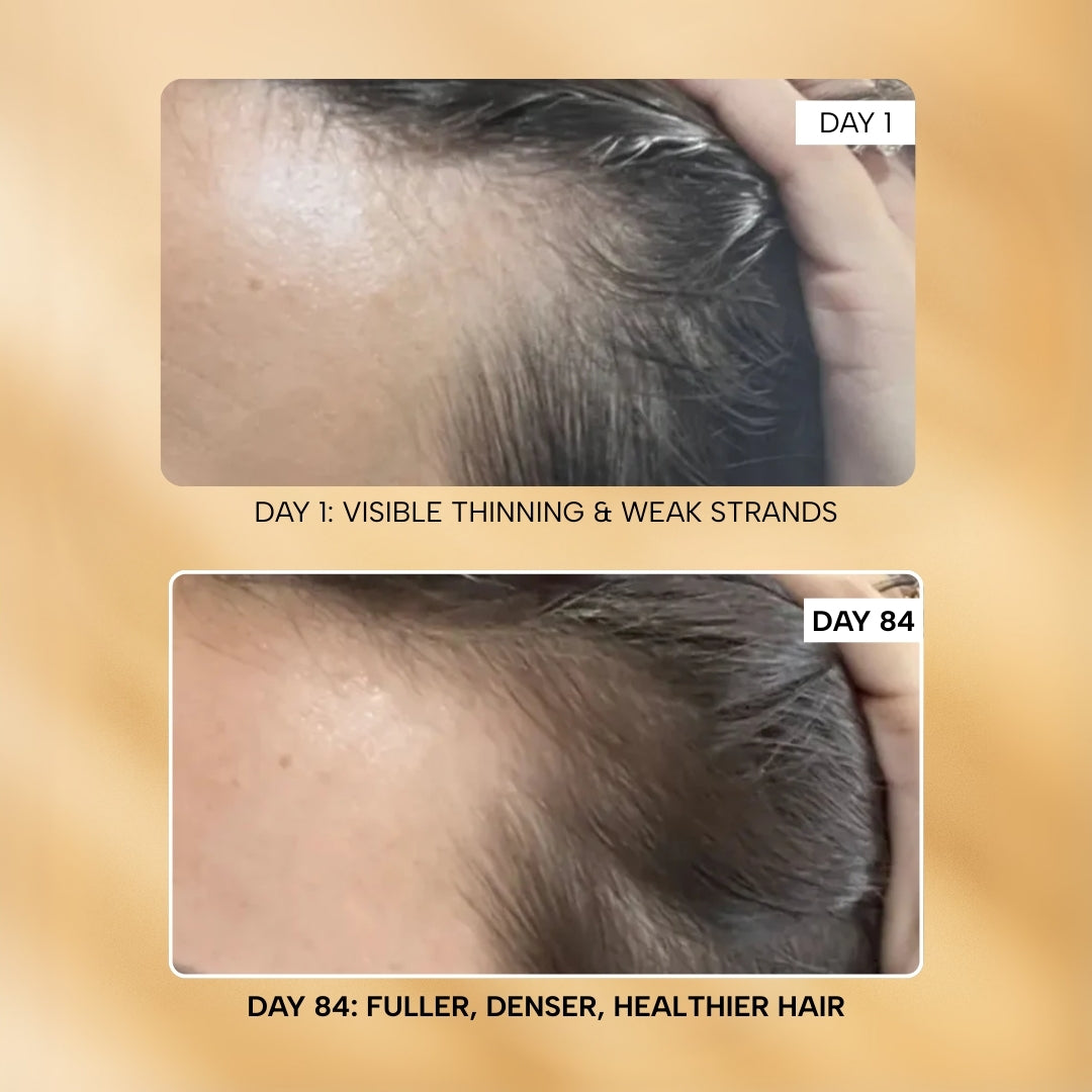 The Hair Root-ine™ Rescue Duo – Strengthen Duo, image 9