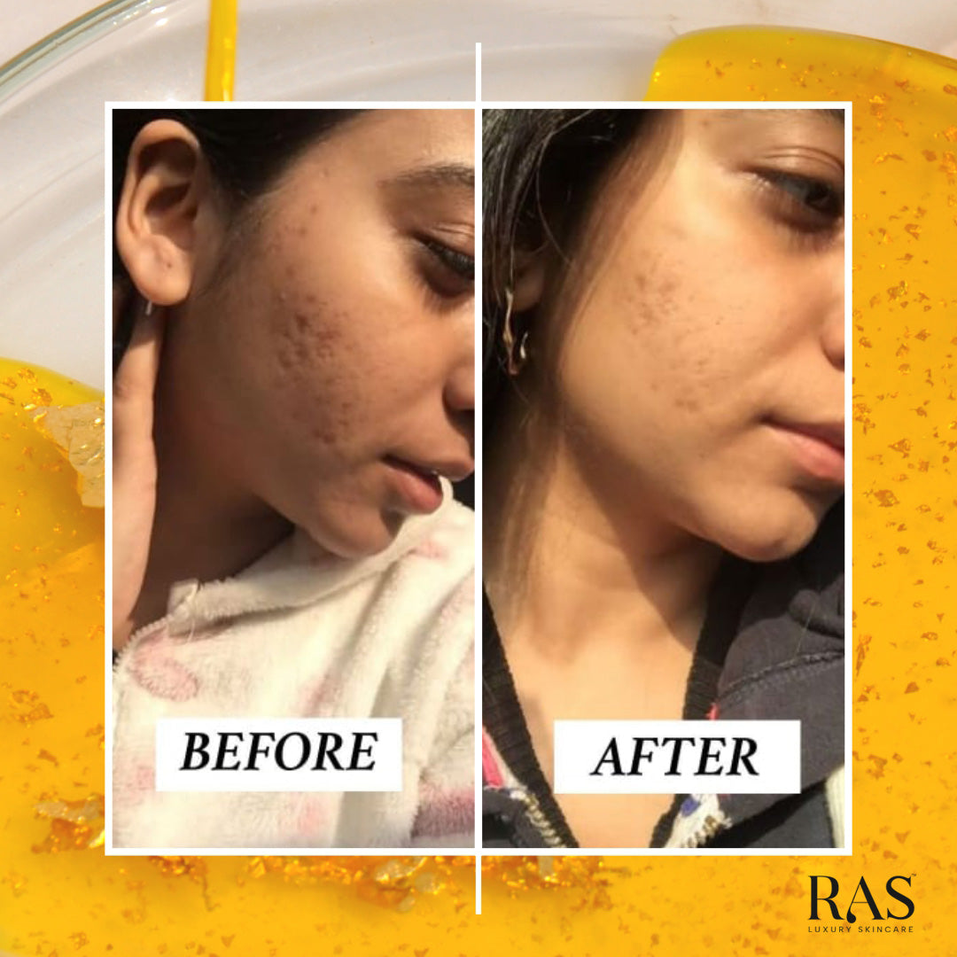 9 Ras Face Everyday Glow Travel Kit with Travel Canvas Pouch – RAS Luxury Skincare