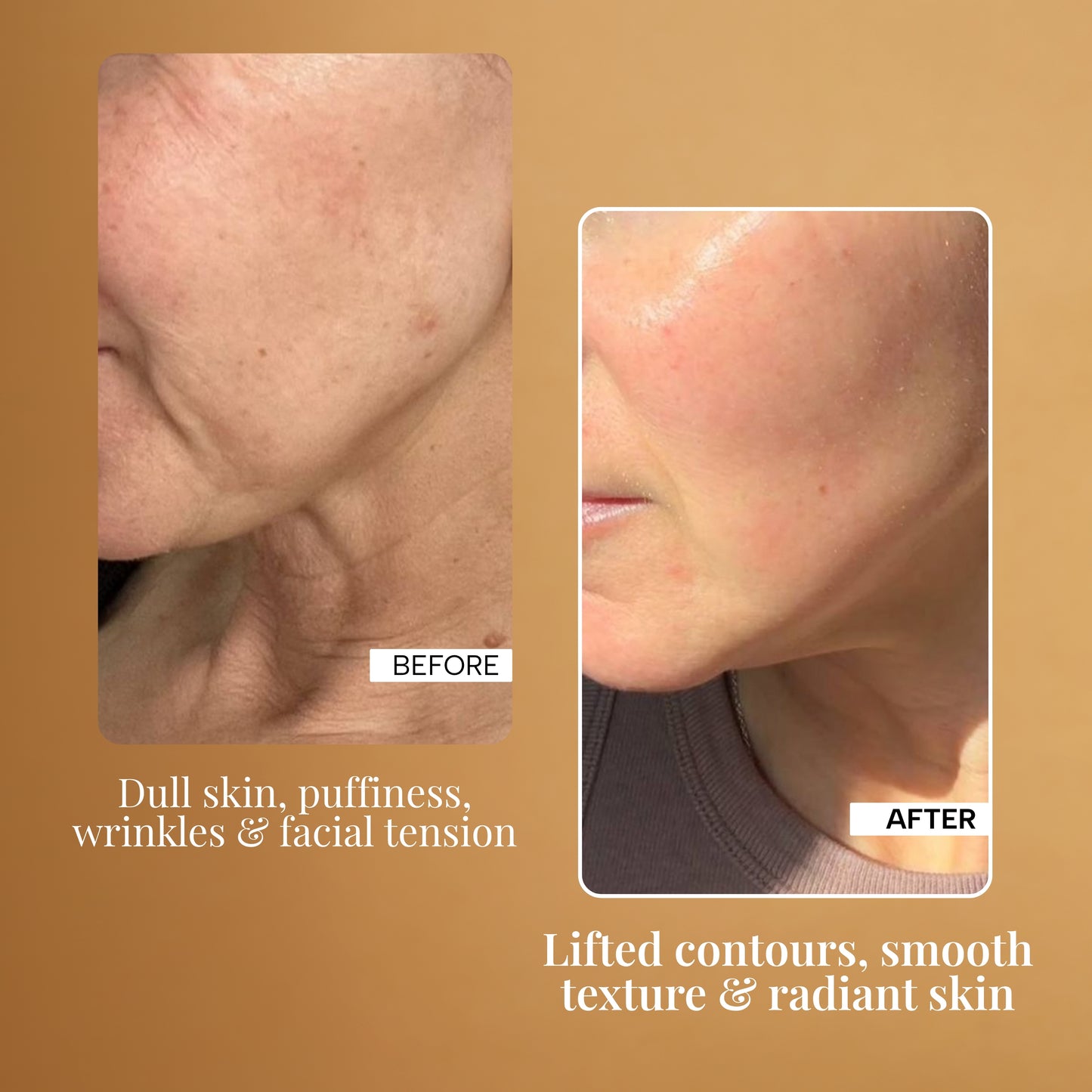 Free 4 in 1 Glowlift Electric Massager + 24K Gold Elixir
