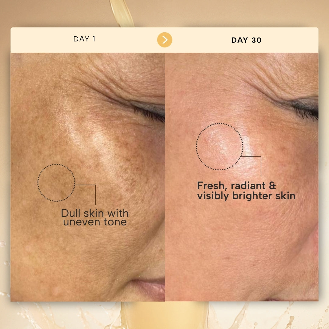 RAS Daily Micro-Resurfacing Milky Essence  toner for gentle exofliation & hydration