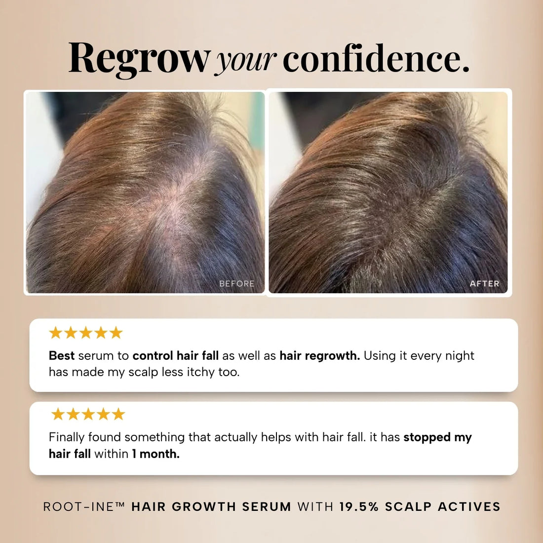 RAS™ Root-ine™ Hair Growth Serum with 19.5% Scalp Actives – 50ML, image 6
