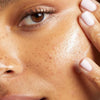Dark Spots & Blemishes