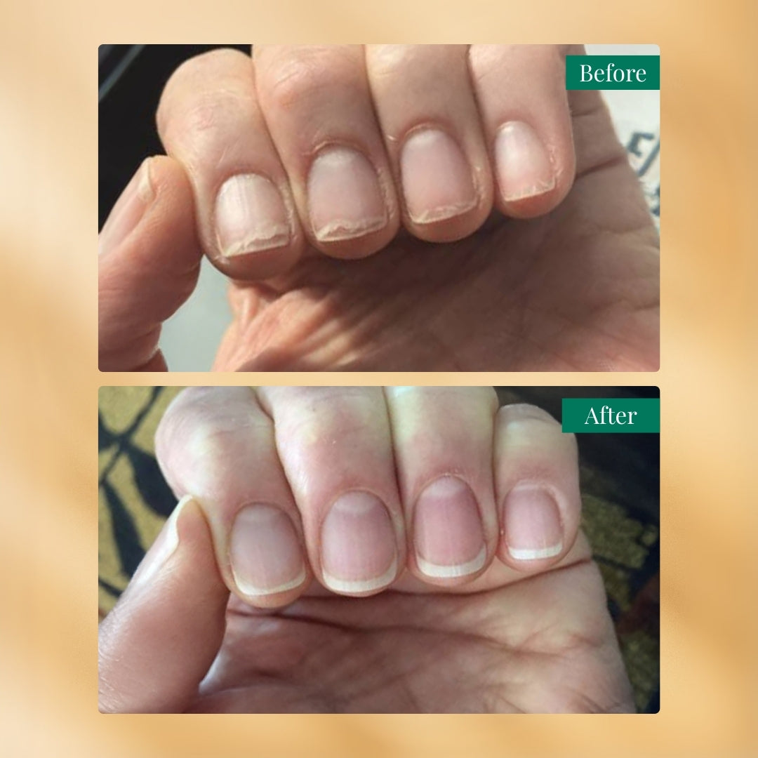 Nailchemy™ Strengthening Nail Serum